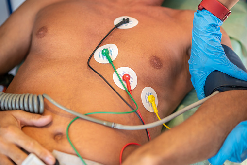 Patient with the electrodes on the chest lying supine while the doctor wrapping the blood pressure cuff around his arm