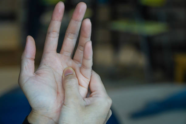 auslösen fingerkrankheit (verriegelung finger oder stenosynovitis-störung), handanatomie mit highlight auf schmerzhaften bereich. der patient hat handschmerzen und fangen von fingerproblem. medizinisches symptomkonzept - pain joint human hand arthritis stock-fotos und bilder
