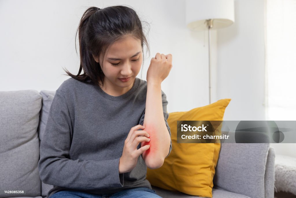 Woman Scratching her Arm Suffer from Allergy Itchy Skin Asian Woman Scratching her Arm Suffer from Allergy Itchy Skin Scratching Stock Photo