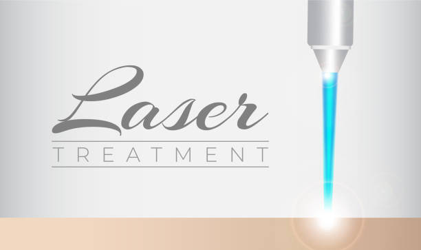 ilustrações, clipart, desenhos animados e ícones de fundo de ilustração de tratamento cosmético a laser - cini