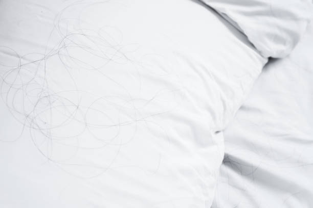 istock close up hair loss fallen on pillow 1428296245