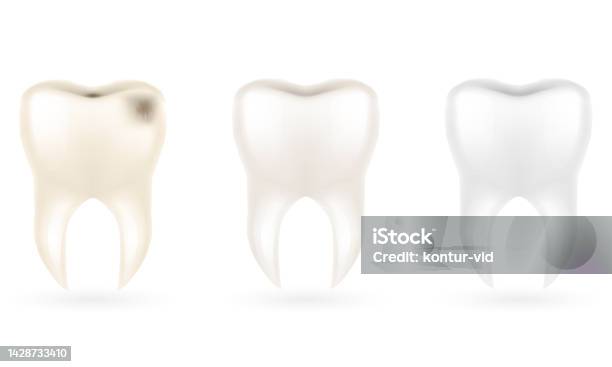 Tooth Root Texture Human Root Tooth Model Vector Illustration Stock Illustration ...
