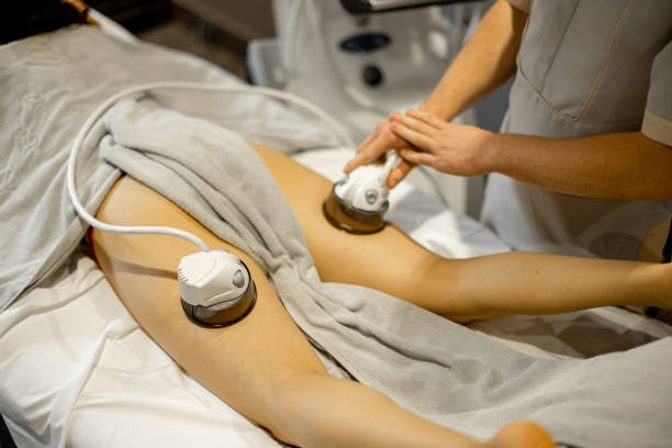 istock Applying vacuum roller massage to a leg 1428946561