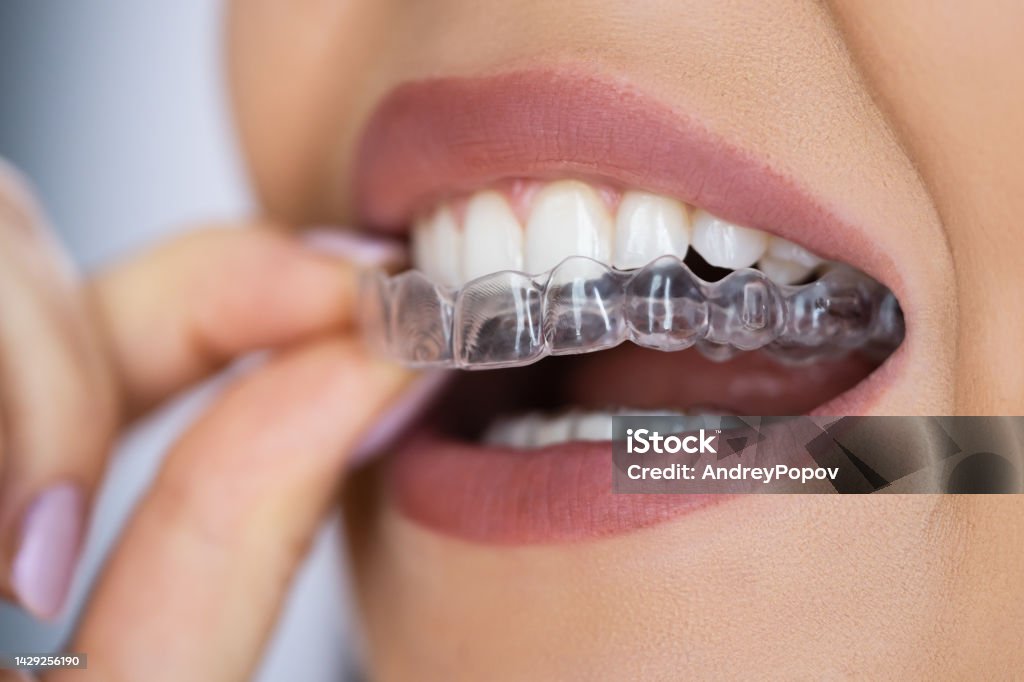 Clear Aligner Dental Night Guard Clear Aligner Dental Night Guard For Teeth Dental Aligner Stock Photo