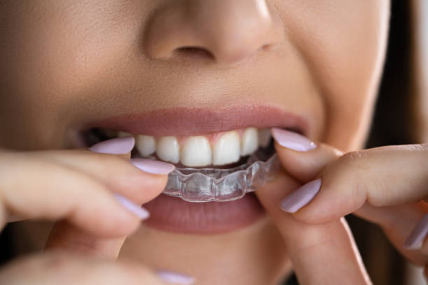 istock Clear Aligner Dental Night Guard 1429256205