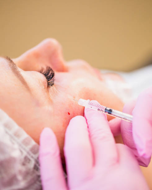 istock Skin rejuvenation medical procedure 1429272781