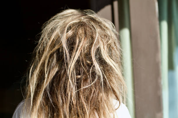 istock Damaged Hair Concept Background 1429412337