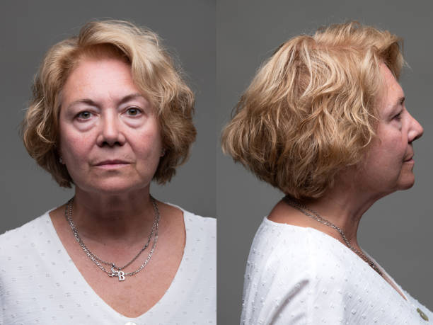 istock Serious Senior Woman front and profile mugshots 1429476189
