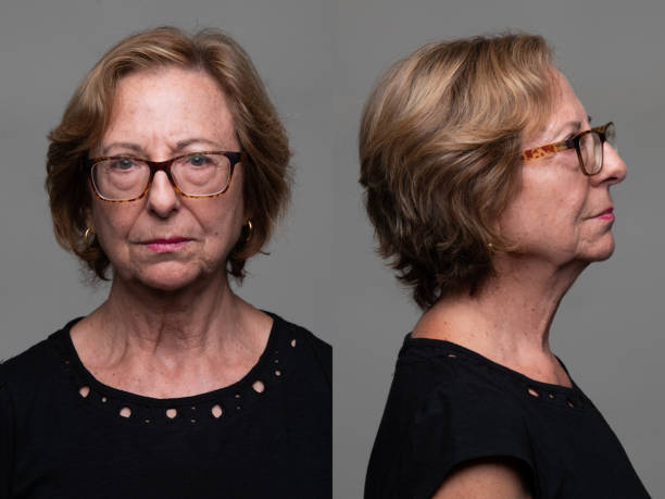 Serious Senior Woman front and profile mugshots stock photo