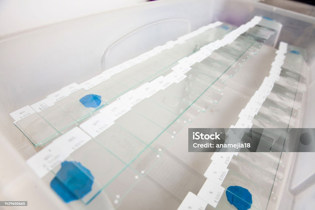 Tissue Samples Scientist Preparing Slides With Paraffin Embedded Tissue Samples For ...