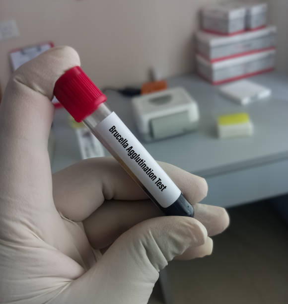 próbka krwi do testu aglutynacyjnego brucelozy do rozpoznania brucelozy. - blood sample blood tube pathologist zdjęcia i obrazy z banku zdjęć