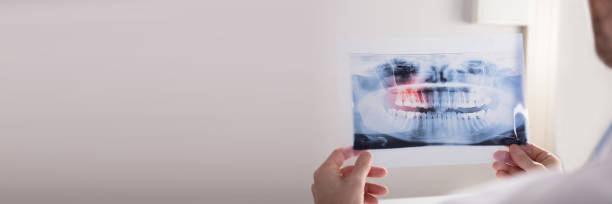 istock Doctor Holding Teeth X-ray 1429968714