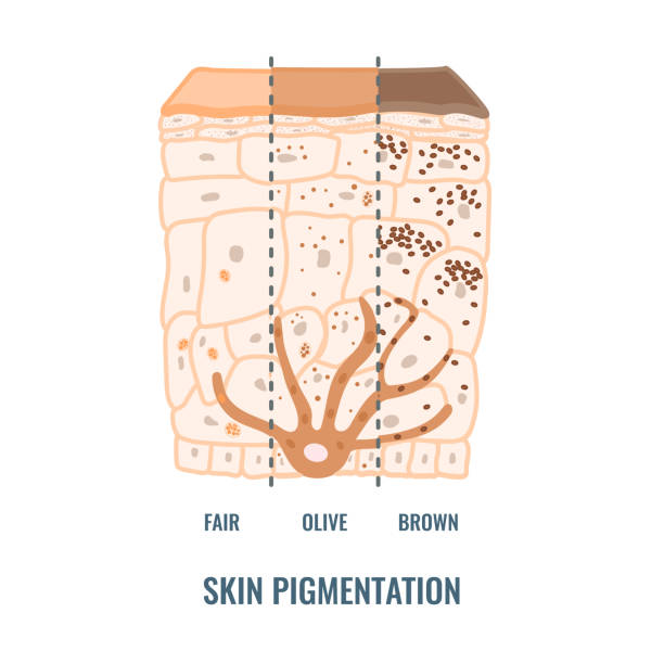инфографика разнообразия пигментации тона кожи человека - melanocyte stock illustrations