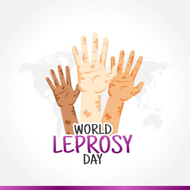 World Leprosy Day Vector Illustration. Suitable for greeting card poster and banner World Leprosy Day Vector Illustration. Suitable for greeting card poster and banner leprosy stock illustrations