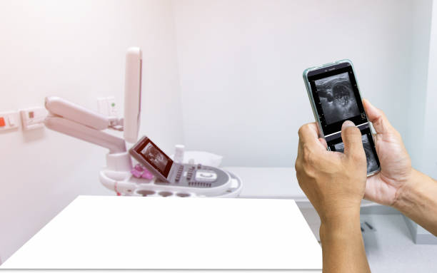 holding smartphone check ultrasound of the patient's thyroid gland was reported on a monitor in the treatment room hospital of thyrotoxicosis, and hypothyroidism, medical image concept. - ultrasound cancer healthcare and medicine thyroid gland imagens e fotografias de stock