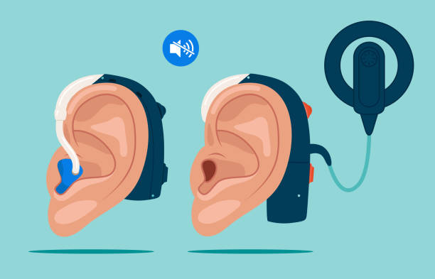 Cochlear implant and hearing aid. Cochlear implant and hearing aid. World Deaf Day in last Sunday of September. Flat vector illustration. human ear stock illustrations