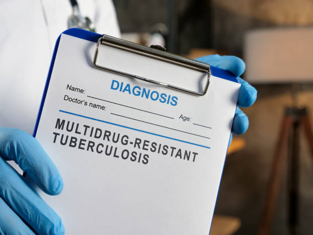 istock Doctor shows diagnosis Multidrug Resistant Tuberculosis MDR TB. 1430290036