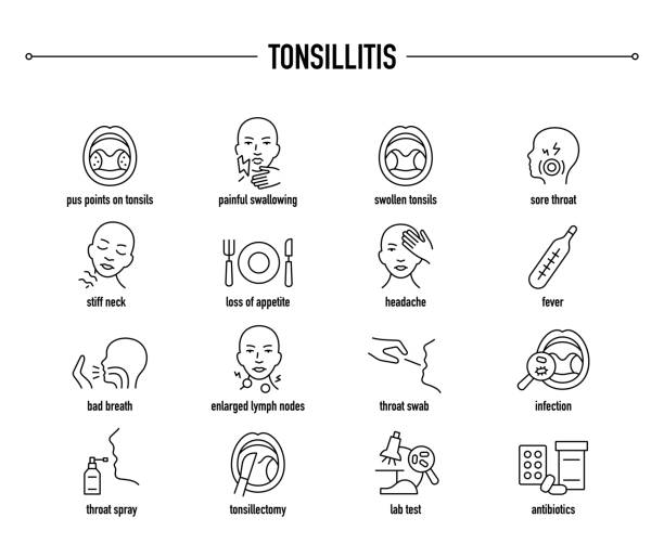 Tonsillitis vector icon set Tonsillitis symptoms, diagnostic, treatment icon set. Line editable medical icons. tonsil stock illustrations