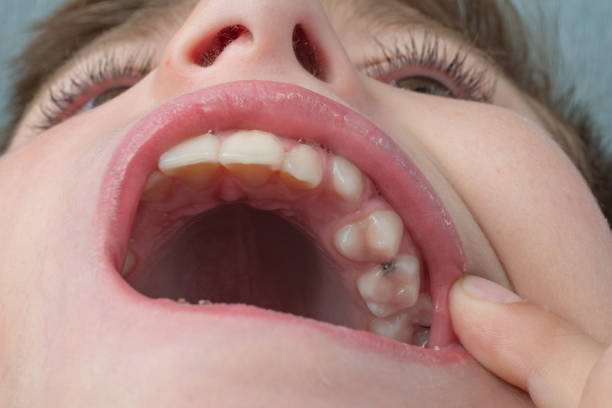 istock Jaw with children's straight teeth close-up. 1430345618