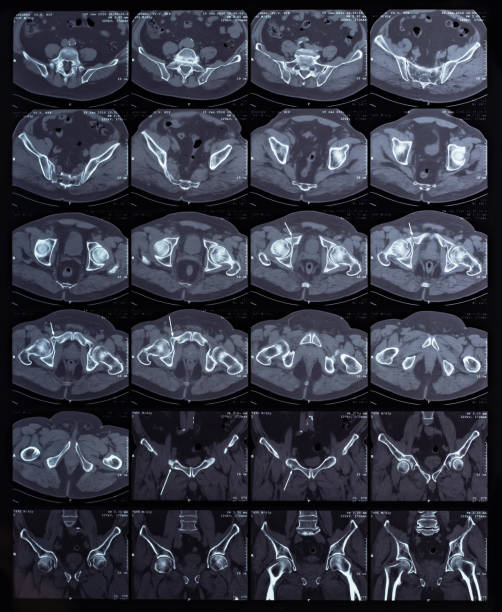 istock Close up of a body CT scan background 1430371861