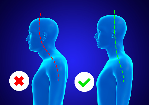 Incorrect and correct posture of the cervical spine of a blue hologram of a man. 3D illustration