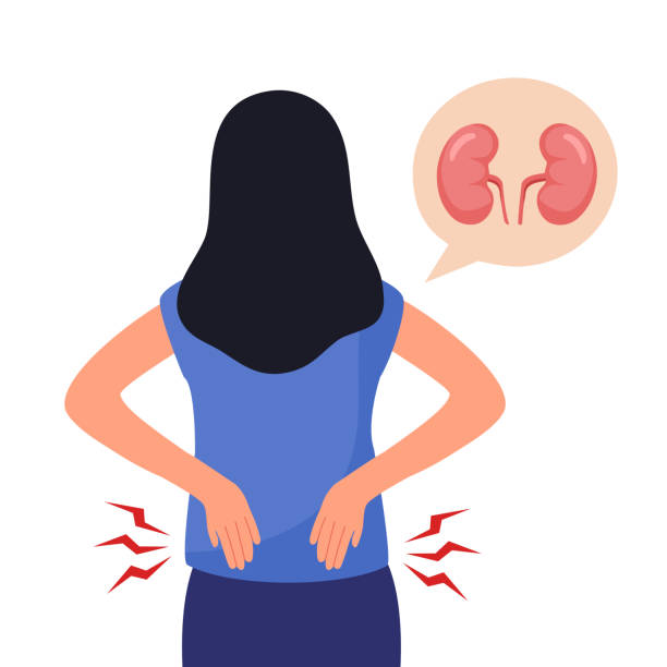 ilustraciones, imágenes clip art, dibujos animados e iconos de stock de mujer que sufre de enfermedad renal crónica en diseño plano. - kidney stone
