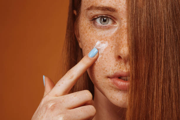istock Red head woman with freckle applying moisturizer on face 1430614170