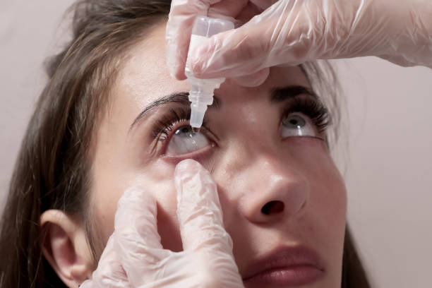istock Close-up attentive optometrist dripping eye drops into the patient's eyes. Optometrist during an examination in a modern clinic 1430813720