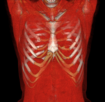 CT Chest 3d rendering showing Rib cage Skeleton Human bones system . Realistic Chest anatomically correct ribcage .