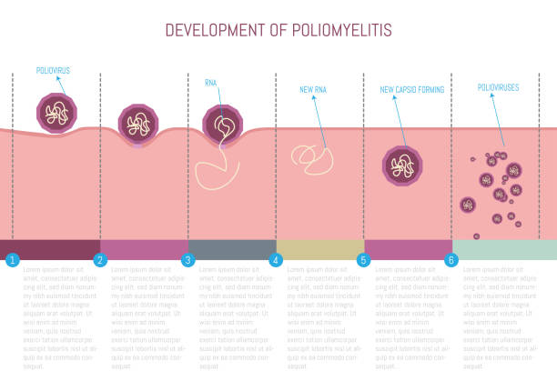 Polio Form 40+ Polio Infographic Stock Illustrations, Royalty-Free Vector Graphics ...
