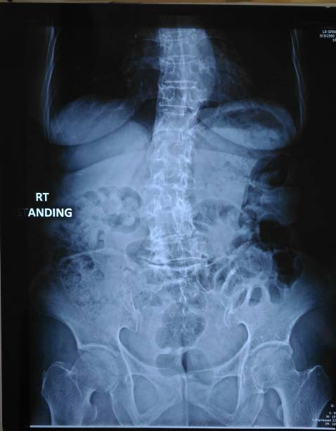 老婆のx線骨膜の背面図。 - radiogram photographic image ストックフォトと画像