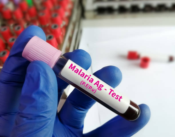 Researcher holding blood sample for malaria antigen test. stock photo