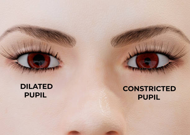 la miose est une condition dans laquelle une ou les deux pupilles se contractent, quelle que soit la quantité de lumière qui pénètre dans l’œil. - eyes narrowed photos et images de collection