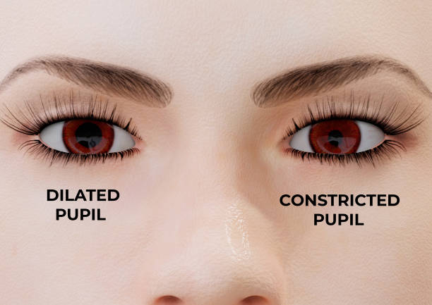 Miosis is a condition in which one or both pupils constrict, regardless of how much light enters the eye Miosis is a condition in which one or both pupils constrict, regardless of how much light enters the eye. 3D illustration dilation stock pictures, royalty-free photos & images