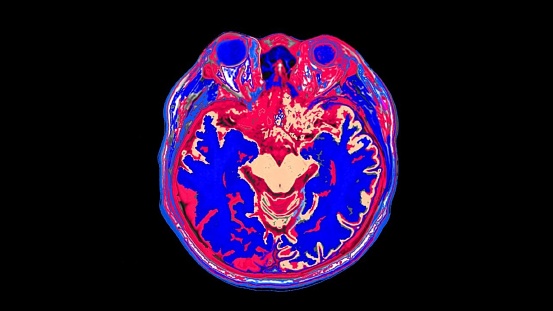 Human brain MRI.