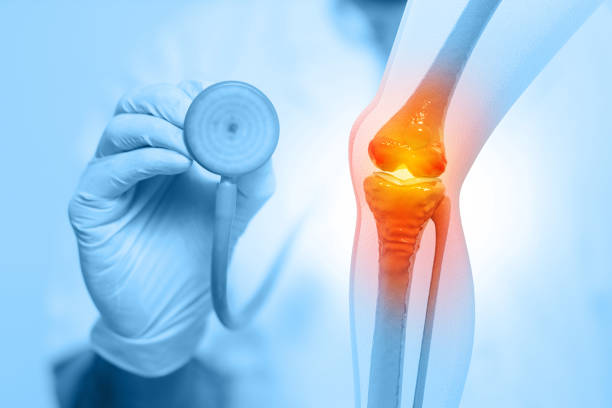 Orthopaedics doctors examining human knee joints. Osteoarthritis, rheumatoid arthritis, joint disease. Knee Joint and bone treatment. 3d illustration stock photo