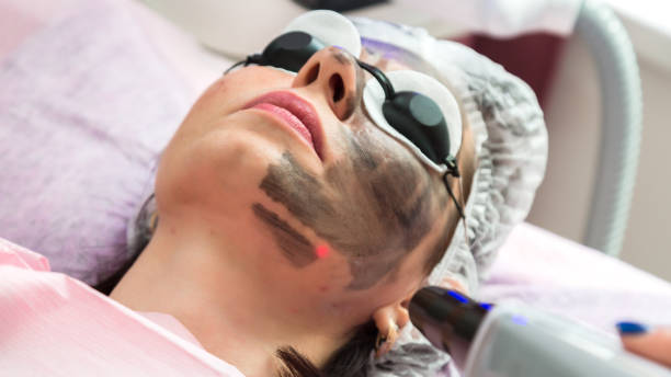 istock A woman in protective glasses with a smeared black mask on her face is undergoing a procedure in a beauty salon 1431366868
