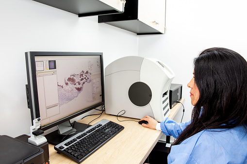 Young female scientist scanning microscope slides with tissue samples for pathology studies. Cancer diagnosis concept. Medical technology concept.