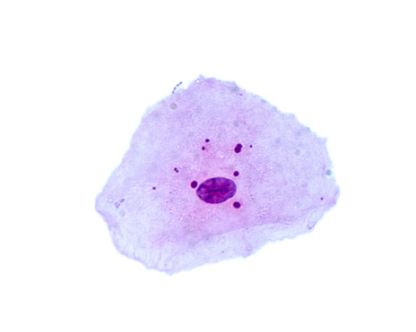 Frotis bucal. Células epiteliales escamosas photo