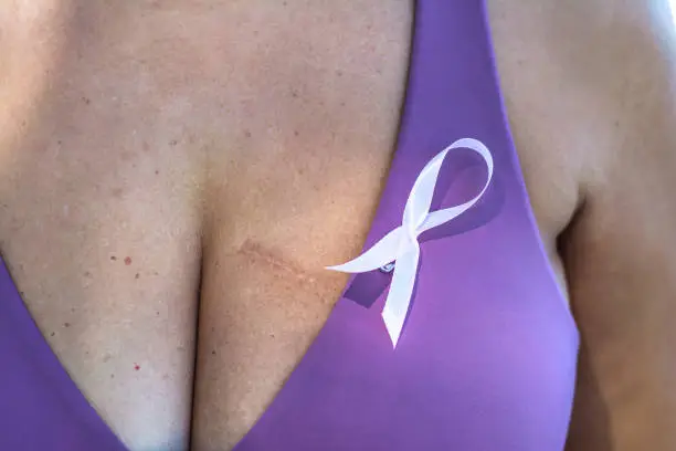 Unrecognizable woman shows breast cancer scar.
Breast cancer awareness day.
Anonymous woman with pink ribbon symbol. Breast Cancer Awareness Day concept.