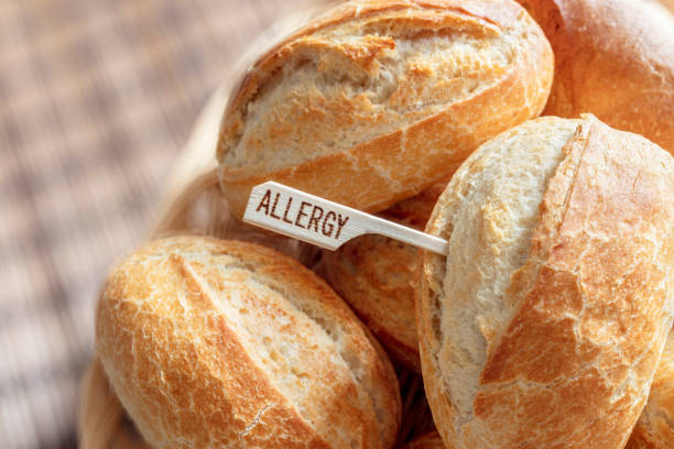 Allergy sign on white bread rolls, gluten intolerance and diet concept Allergy sign on white bread rolls, allergic gluten intolerance and diet concept food allergies stock pictures, royalty-free photos & images