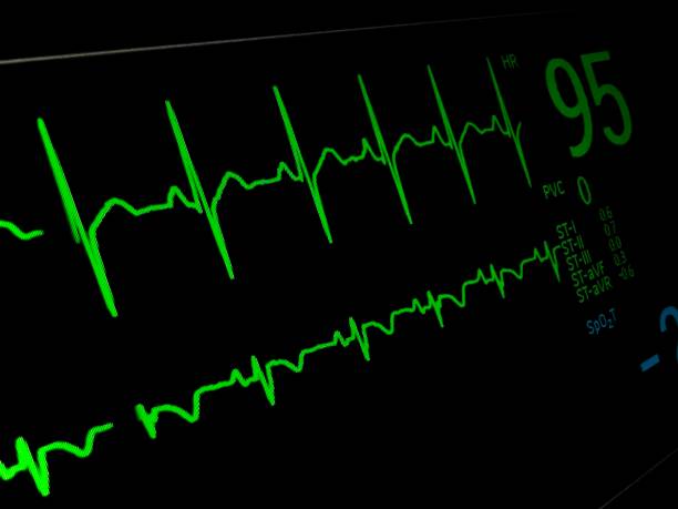 istock Echocardiogram monitor heartbeat 95 1431812389