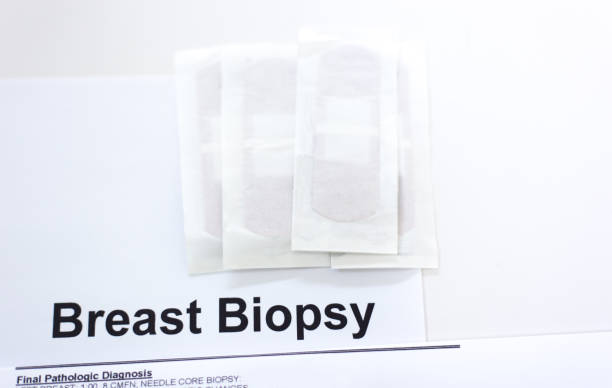 istock Breast Biopsy Diagnosis, Band-aids 1431839205