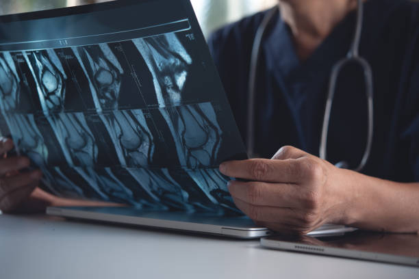 수술 전에 환자 뼈 x 선 필름을 들고 보는 의사. mri 및 ct 스캔은 병원의 방사선 정형 외과 단위에서 검사합니다. 무릎 관절 엑스레이 - 엑스레이 이미지 뉴스 사진 이미지