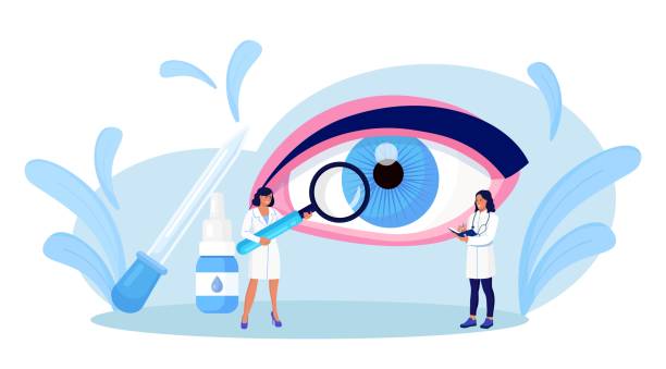 augenheilkunde. tiny doctors behandelt und untersucht augen, sehvermögen. medizinische sehkraftuntersuchung, diagnose. linsenuntersuchung und netzhautkorrektur - human eye eyesight optometrist lens stock-grafiken, -clipart, -cartoons und -symbole