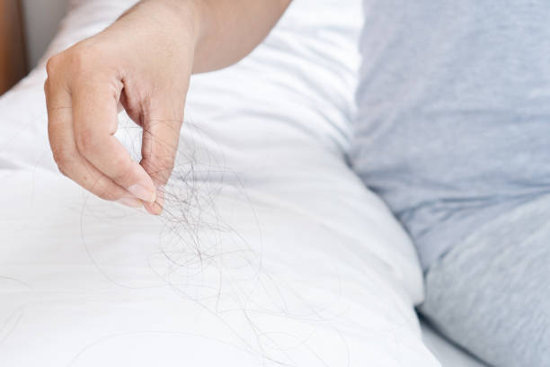 istock closeup hand holding hair loss fallen on pillow 1432100774