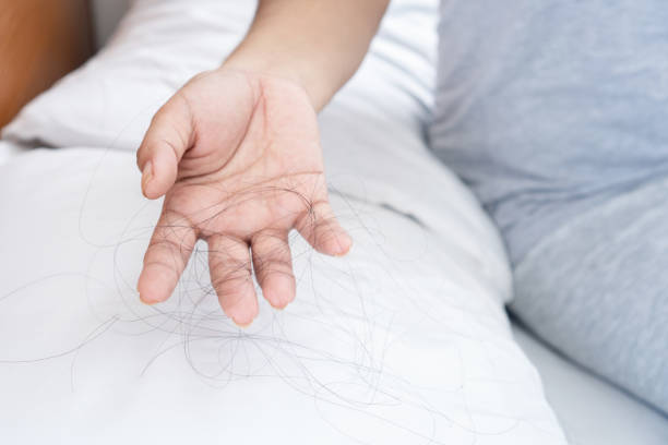 closeup hand holding hair loss fallen on pillow stock photo
