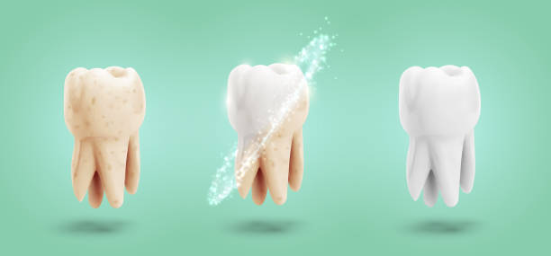 ilustrações de stock, clip art, desenhos animados e ícones de vector set of three molars. tooth cleaning, care and protection - equal opportunity flash