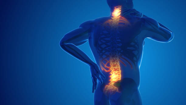 Pain in the back and neck joint 3D illustration Pain in the back and neck joint 3D illustration chronic illness stock pictures, royalty-free photos & images