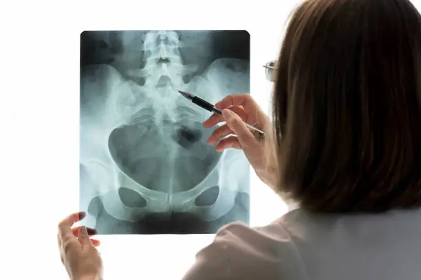 Photo of Female doctor holds and examines pelvic bones scan against background of light screen. Radiologist points to problem areas on X-ray